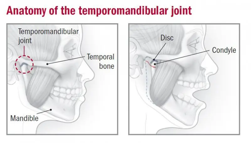 Jaw Pain/TMJ Dysfunction